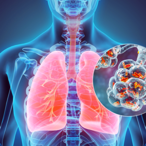 7GFEJDVM65FEBOO2PL3CTL23OY